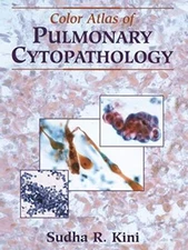 Color Atlas of Pulmonary Cytopathology                                         