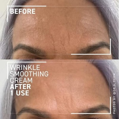 DR BRANDT NEEDLES NO MORE WRINKLE SMOOTHING CREAM 0.5 OZ - 100000000738-1PK