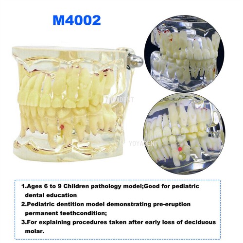 Modelo de dientes tipodonte dental ortoimplante patológico período práctica modelo de demostración - Imagen 27 de 49