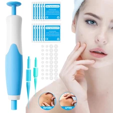 2in1 Painless Auto Skin Tag Mole Wart Removal(40x Rubber Bands +10x Alcohol Pad)