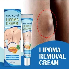 20g Lipoma Soothing Cream Instant Ointment Relieving Discomfort Fat GOOD
