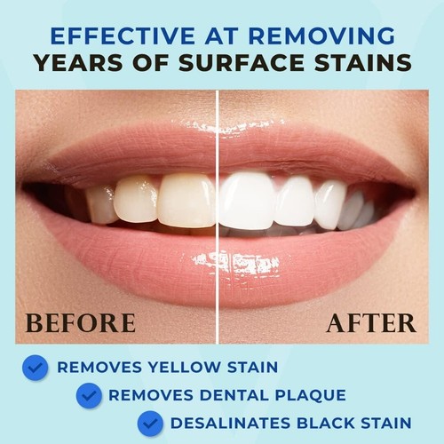 2x Teeth Whitening Gel Pen 20+ Uses Professionally Formulated Low Sensitivity - Picture 2 of 8