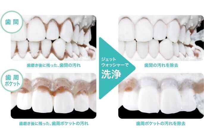 Panasonic EW-DJ55-W Electric Dental Flosser Jet Washer Panasonic EW-DJ55-W Electric Dental Flosser Jet Washer