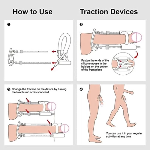 Male-Penis-Extender-Growth-Enlargement-System-Enlarger-Stretcher-Enlonger AUS - Picture 4 of 10