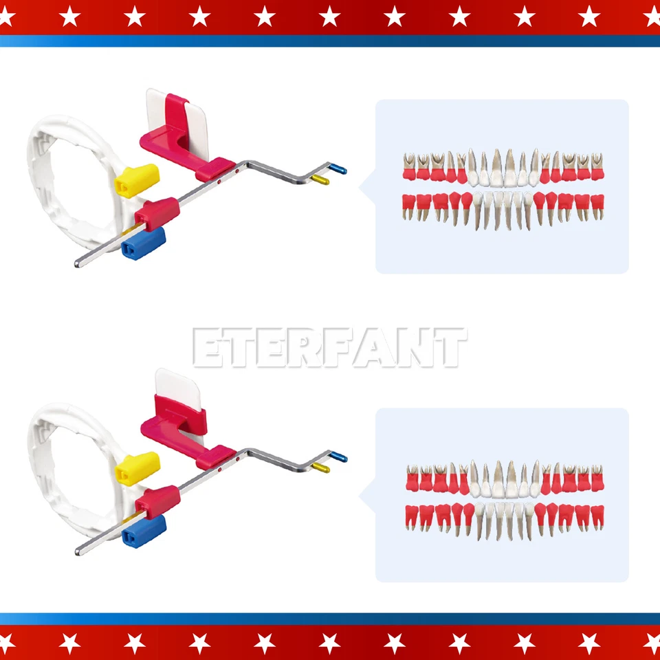 Sistema de posicionamiento de rayos X estilo XCP-ORA 30XUniversal brazo de puntería codificado por colores Rinn  Foto 4 de 4