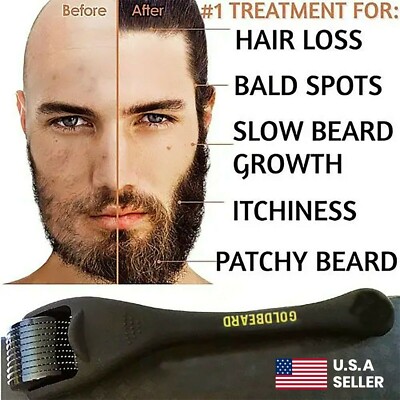 Beard Derma Roller For Hair Loss Beard Growth Titanium Derma Roller Micro Needle
