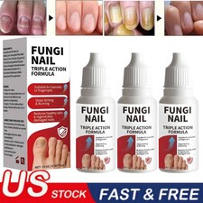 1-5PC Fungi-Nail Anti-Fungal Liquid Solution Kills Fungus That Can Lead To Nail