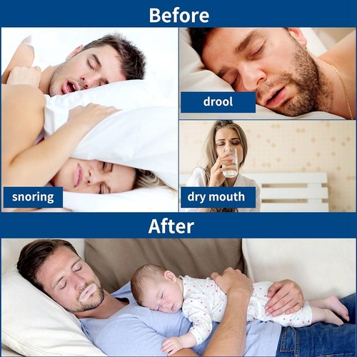 UP 300x Strips Gentle Mouth Tape Better Nose Breathing Instant Snoring Relief AU - Picture 3 of 4