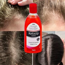 Ayurvedic Anti-Dandruff Treatment Shampoo For flaking scaling & itching 100-ml