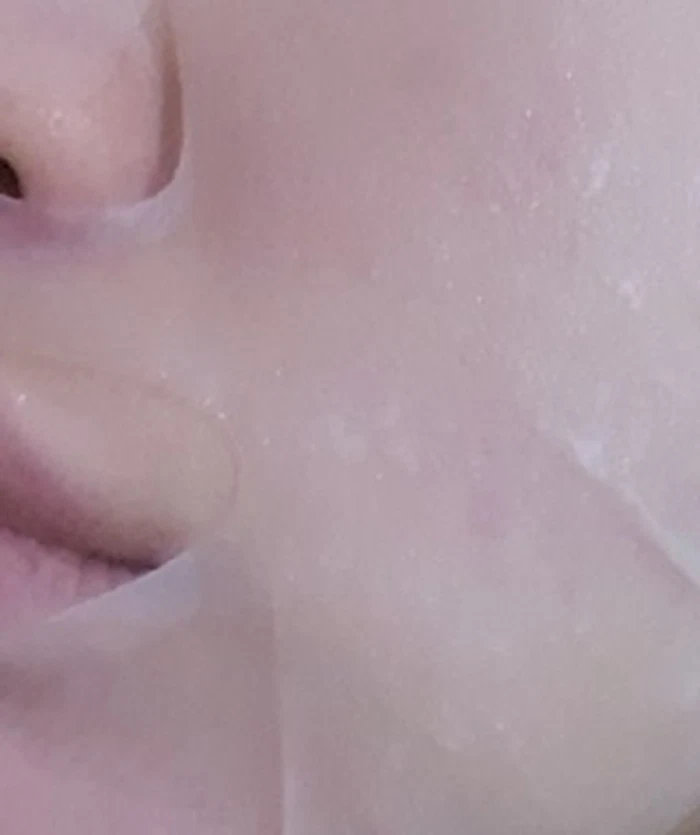 COSRX AC Blemish Calming Sheet Mask 26ml*5 Soothe Hydrate & Refresh Trouble Skin - Image 4 of 4