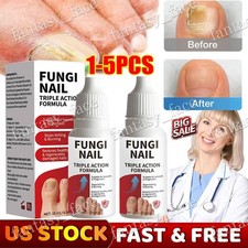 Fungi-Nail Anti-Fungal Liquid Solution Kills Fungus That Can Lead To Nail