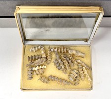 Archimede Bryozoan Fossils Mississippian Periodo X 21 Forma Vite Distintiva