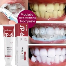 Sip-6 Toothpaste, Whitening Sp-6 Toothpaste, Sp-6 Probiotic Whitening Toothpaste