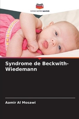 Syndrome de Beckwith-Wiedemann by Aamir Al Mosawi (French) Paperback Book
