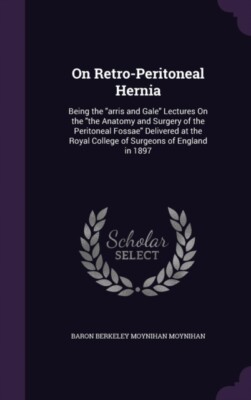 Moynihan - On Retro-Peritoneal Hernia  Being the arris and Gale Lect - X555z