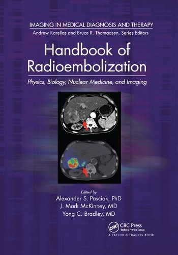 Handbook of Radioembolization - 9780367874681