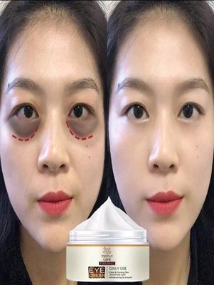 Lighten Dark Circles, Tighten Eye Bags, Deeply Moisturize Skin Around Eyes
