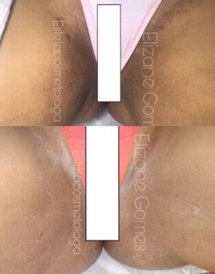 MONNASKIN Algae Pell (peeling De Algas)