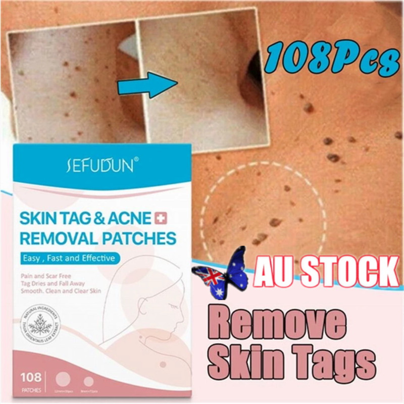 108PCS Skin Tag Remover Patch ~ AU Stock ！