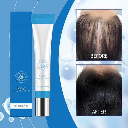 3 Stück Scalphy Haarwachstum Behandlung Serum Scalphy Haar Ampulle nicht fettig - Bild 11 von 19