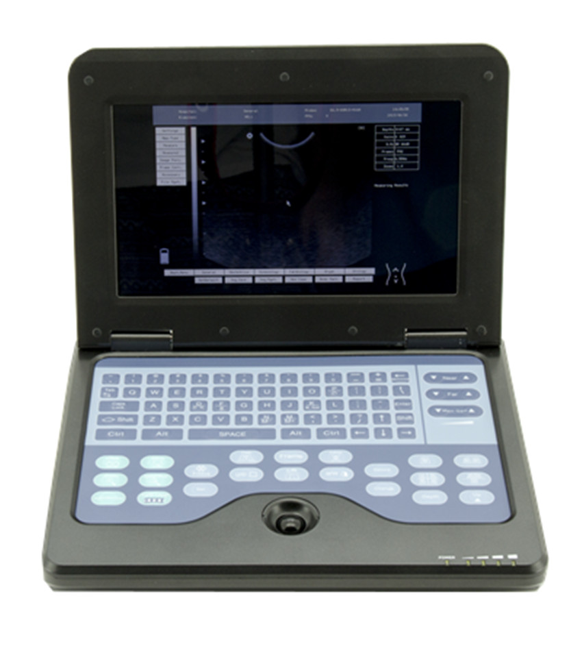 CONTEC CMS600P2 Portable Laptop Machine B-Ultrasound Scanner Linear Probe
