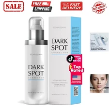 Dark Spot Remover Face & Body Serum: Age Spot Sun Spot Freckles Melasma Brown...