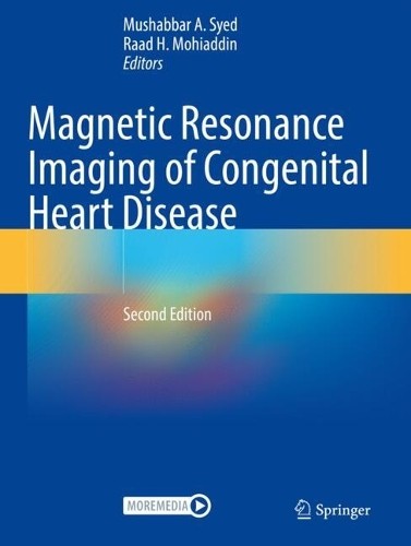 Magnetic Resonance Imaging of Congenital Heart Disease - 9783031292378
