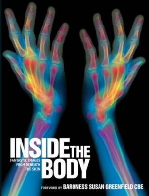 Inside the Body: Fantastic Images from Beneath the Skin