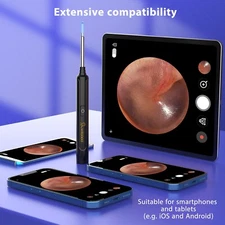 Ear Wax Removal Kit,1296P HD Earwax Cleaner Portable USB Charging Visible 6 LED