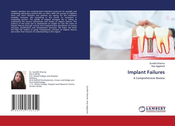 Sunidhi Sharma (U. A.) | Implant Failures | Taschenbuch | Englisch (2021)-image