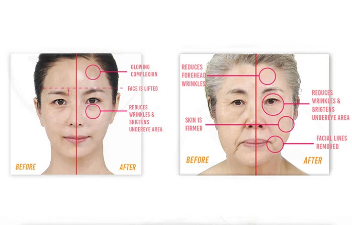 CLEDBEL Power Lift Program One Kill V Lifting 24K Gold Lifting Mask 70ml Newist - Image 4 of 4