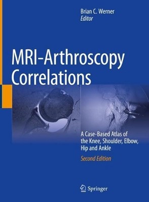 MRI-Arthroscopy Correlations: A Case-Based Atlas of the Knee, Shoulder, Elbow, H