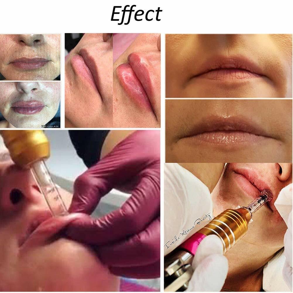 Suchergebnis Auf Für: Hyaluron Pen Ampullen