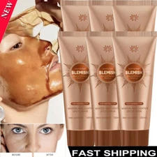 Herbal Spots Peel-Off Facial Mask for Deep Cleansing Acne Whitening Skin 100ml