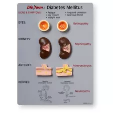 Life/form Diabetes Mellitus Teaching Kit NEW Nasco WA20495 9x12 Plaque