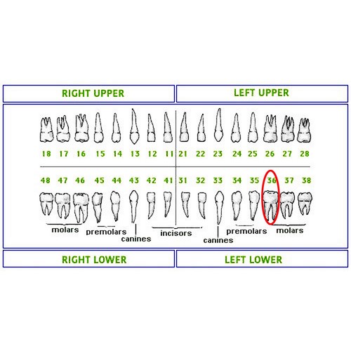 Columbia 860 Style Dental Typodont Model Licensing Exam 32 Pcs Removable Teeth - Picture 42 of 46