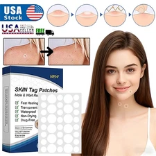 720Pcs Skin Tag Remover Patches Quick Effective Mole Wart Removal Pad Sticker