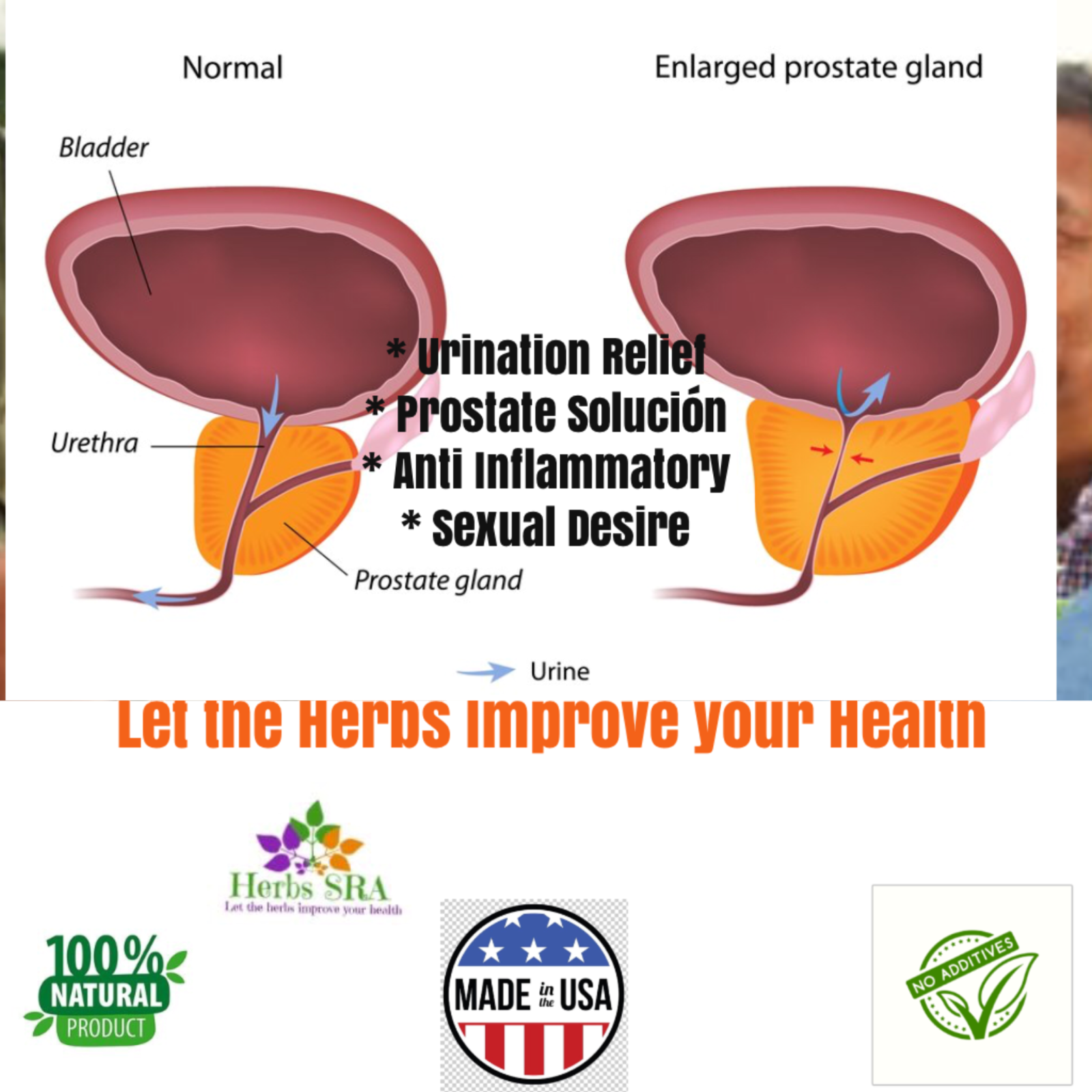 SAW PALMETTO, BETA SITOSTEROL, CAT'S CLAW Extract, Prostate Supplement