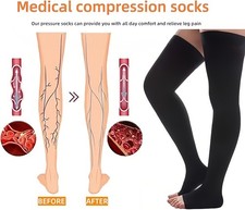 Compression Sock 30-40mmHg Thigh High Support Stockings Medical Relief Open Toe