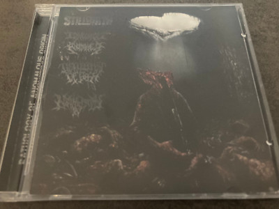 V.A. PATHOLOGY OF ANOMALOUS ORIGIN - 4 Way Split CD Stillbirth Nephrectomy u.a.