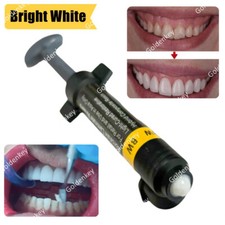 Carillas de resina compuesta para carillas dentales blanqueamiento dental súper blanco
