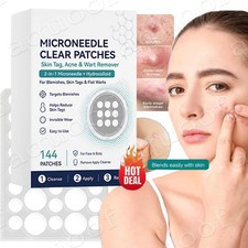 Curalona Microneedle Patches 144pcs, Skin Tag Wart Acne Remover Patches,Hot Sale