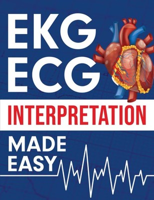 EKG | ECG Interpretation Made Easy: An Illustrated Study Guide For Students ...