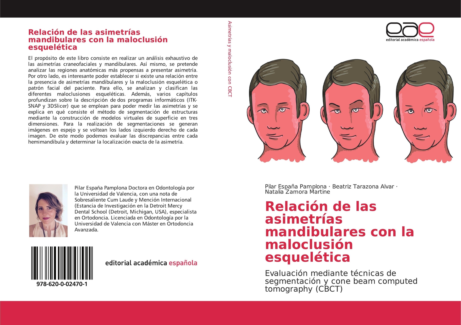 Thumbnail - Relación De Las Asimetrías Mandibulares Con La Maloclusión Esquelética