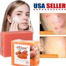 Original Kojic Acid Soap for Dark Spots Whitening, Turmeric Soap Skin Lightening