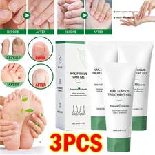 3X Nutraboost Nail Fungus Treatment Gel, Nail Fungus, Fungus Cream US (-20%OFF)