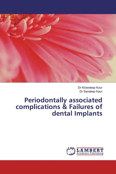 Periodontally Associated Complications & Failures Of Dental ... 9783659553301-image