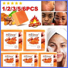Kojic Acid Soap Bars Dark Spot Remover Turmeric Brightening Face Body Skin Care