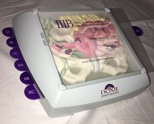 OVARIAN CANCER 3-D MODEL Female Uterus Vagina Cervix Anatomical Teaching OB GYN - Picture 4 of 6