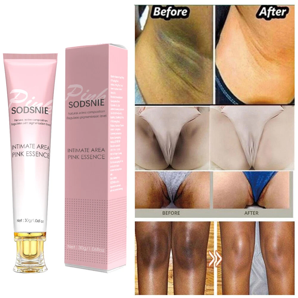 Intimate Area Cream Skin Lightening Bleaching Anus Lightening Vaginal  Whitening | eBay